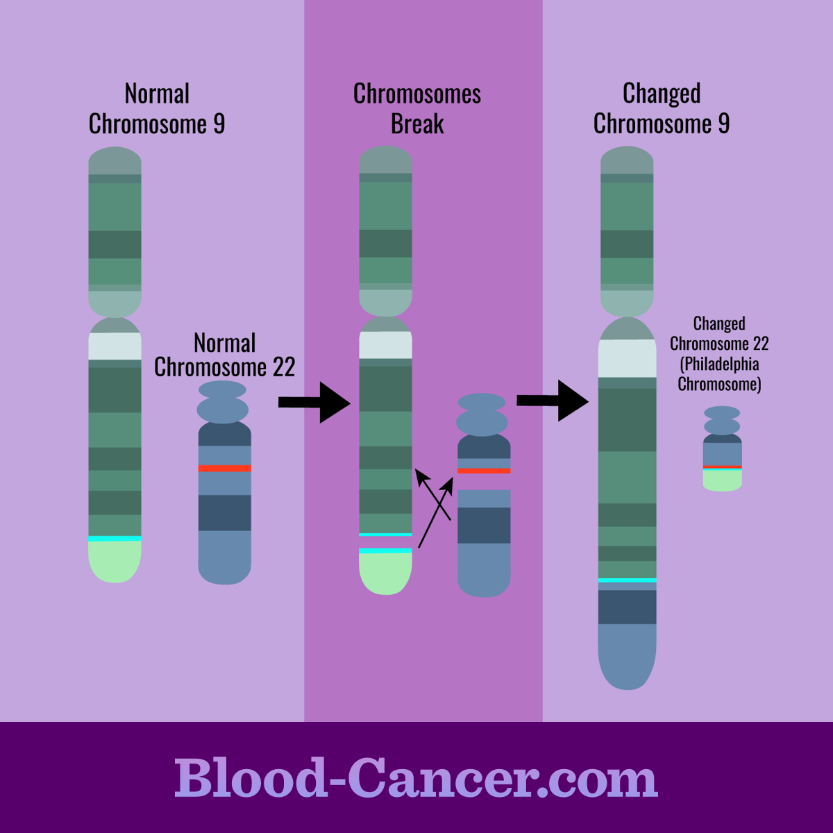 Normal chromosomes 9 and 22 break and switch pieces, forming a chromosome called the Philadelphia chromosome