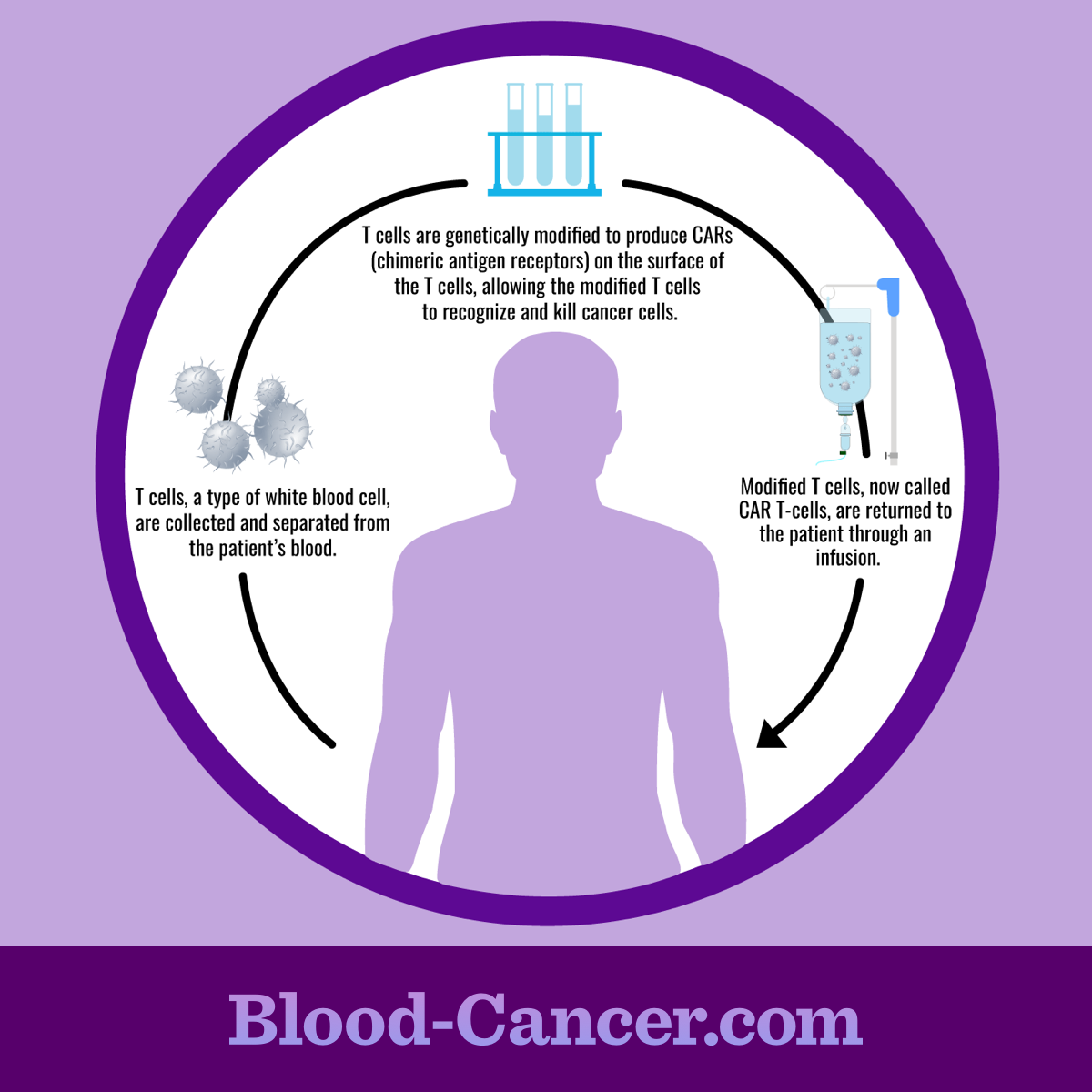 Process of extracting & separating T-cells from blood, producing special receptors on the cells, and infusing into patient