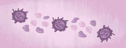Understanding Hairy Cell Leukemia image