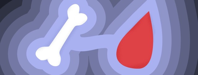 What Is Chronic Lymphocytic Leukemia (CLL)? image