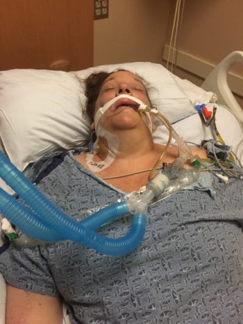 A woman in a hospital bed with my tubes inserted