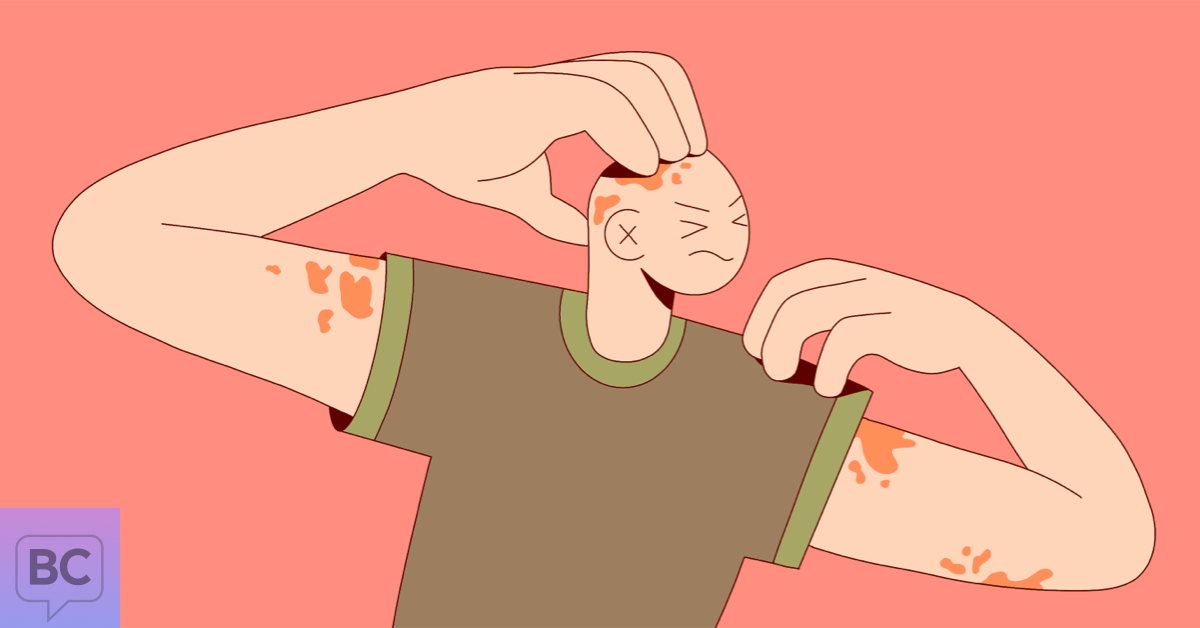 Rash Decisions Chronic Myeloid Leukemia and the Skin I'm In