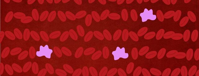 What are Myeloproliferative Neoplasms (MPNs)? image
